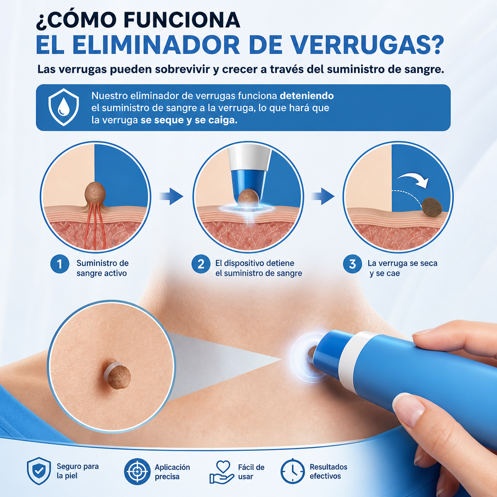Kit de eliminación de verrugas