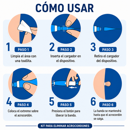 Kit de eliminación de verrugas